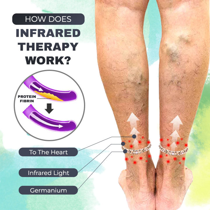 Varicose Veins Therapy Anklet