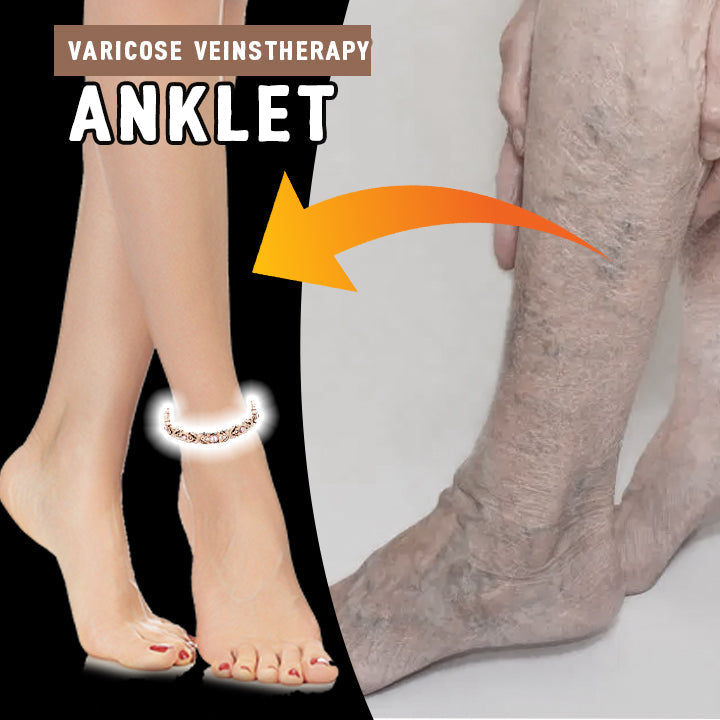 Varicose Veins Therapy Anklet